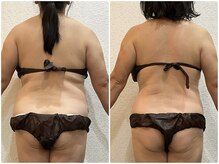 美容整体 ウェリナ 蟹江院/小顔矯正/骨盤矯正/美脚サロン