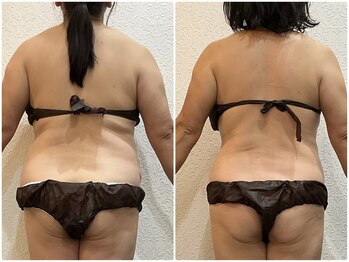 美容整体 ウェリナ 蟹江院/小顔矯正/骨盤矯正/美脚サロン