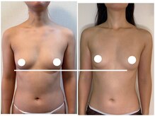 ハーズプラス(hers+)/バストは育てながらダイエット