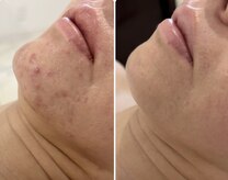 エステティック トリートメント クオリティ(Esthetic Treatments Quality)
