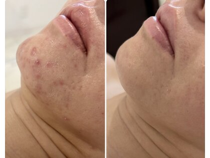 エステティック トリートメント クオリティ(Esthetic Treatments Quality)の写真