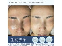 泡のきもちの雰囲気（癒しのうるおい生泡毛穴洗浄でくすみや毛穴オフ◎コリ改善◎）