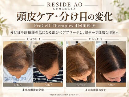 リサイド アオ クマガヤ(RESIDE AO KUMAGAYA)の写真