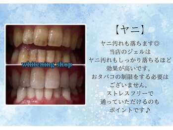 ホワイトニングショップ 秋田店/【ヤニ汚れも落ちます!】