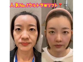 東洋経絡リラクゼーション