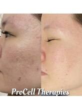 アイルーム(i.room)/