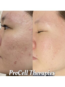 アイルーム(i.room)/