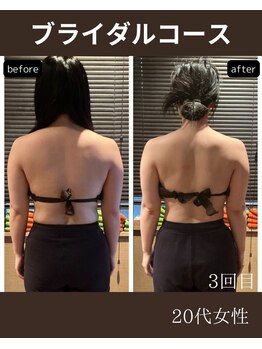 ミーツ(MEETS)/ブライダルは背中が命!