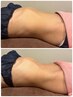 新メニュー　骨盤から整え結果がでるYOLO式腸もみ　14000円