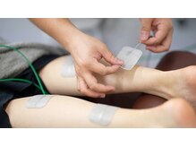 マカナ接骨院(Makana接骨院)/ハイボルテージ施術♪