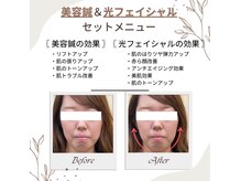 れんげ鍼灸整骨院の雰囲気（清潔感がある店内♪半個室になるので周囲の視線も気になりません）