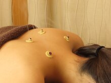 仁泉鍼灸院/しょうが灸