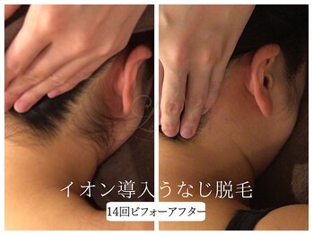 リノ(Lino)/うなじ脱毛シェービング付♪