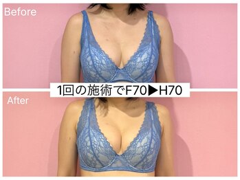 ククナ(KUKUNA)/*バストアップマッサージ*