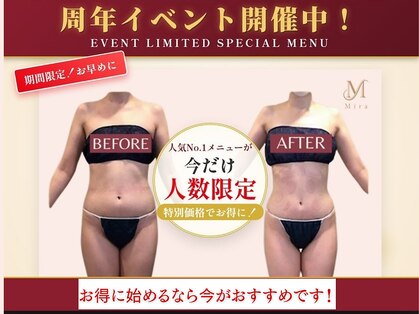 ミラ 札幌店(Mira)の写真