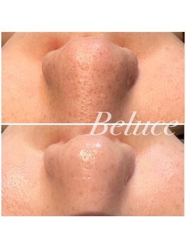 ベルーチェ(Beluce)/1度での結果 こだわっています