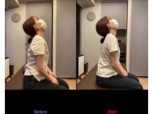 オンリーワン 整体院(Onlyone)/猫背矯正で首のつまりがスッキリ