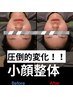 小顔整体¥10000（通常¥11000）