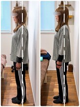 イズム まつもと店(izm)/小顔モニター様