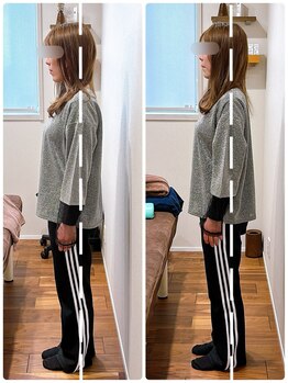 イズム まつもと店(izm)/小顔モニター様