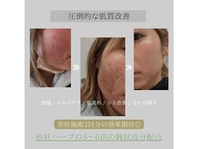 アムリリー 南草津店(AMRILY)の雰囲気（勧誘はしません× お悩み解決に向け、ご提案させて頂きます。）