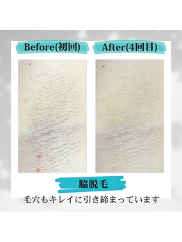 ナンバーフォー 池尻大橋(No.4)/Before & After (脇)