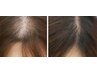 【毛量でお悩みの方必見】タンパク質500種類配合☆育毛コース¥8000→¥5000