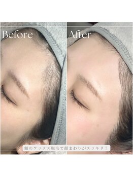 ルーディーアイズ(Loody eyes)/オプション！額ワックス脱