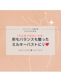 チュラ 大宮店(Chura)/左右差が劇的に改善!!(1/2)