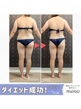 ミノ 美里大通り店(mino)/ダイエットパッケージプラン