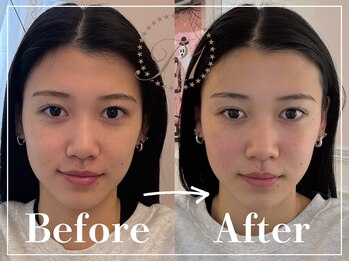 R-1ビューティーサロン 表参道/Before&After