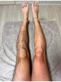 アンドエス 六本木(and S.)&nbsp;before、afterがこんなに変わるワックス脱毛☆お任せください。