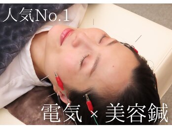 琴似女性の治療院の写真/《リピーター様多数！》当店人気No.1☆【動かせない筋肉へアプローチ】電気×美容鍼 [60分￥9900！]