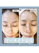 ニコ ウィズ(Nico with)/【透明感、美肌】マーメイドセル