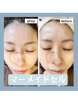 ニコ ウィズ(Nico with)/【透明感、美肌】マーメイドセル