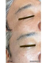 ブリス(Bliss)/ハーブトリートメント3g1回