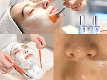 グレースフィオーレ 西宮北口店(gracefiore)の写真/【最先端☆肌管理】韓国第4世代ララピール&進化版セラピールー(パック込)☆認定公式サロン☆