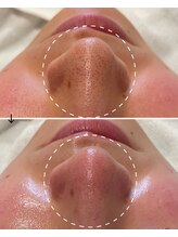 サロン モジョ(mojo)/アクアピール