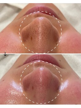 サロン モジョ(mojo)/アクアピール