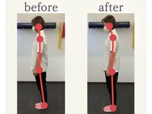 ケアラボ 真岡/立ち上がりで股関節の痛み