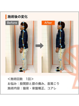 ただき接骨院 整体院 高崎本院/お悩み：股関節・膝痛、首肩こり