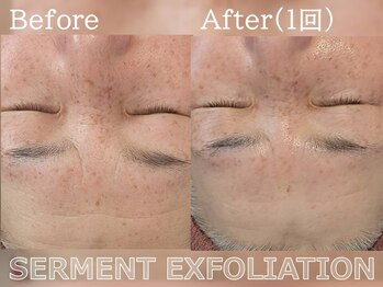 ルナステラ 金沢店/セルマンピーリング