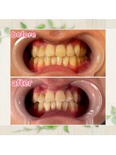 パルティービューティー 天満店(PARTIE BEAUTY)/お客様の変化をお届け【No.3】