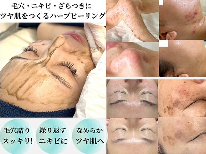 プリュボーテ(Pul Beaute)の写真