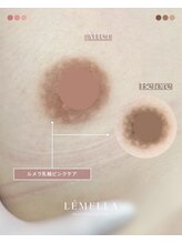 エルビービュティーサロン(LB BEAUTY SALON)/【ルメラ乳輪】実績数関西1★
