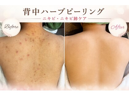 ウルワシ(Uruwashi)の写真