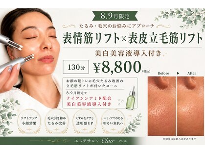 クレル(Clair)の写真
