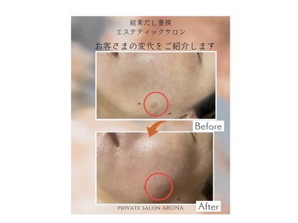アローナ(ARONA)の写真