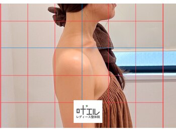 叶'エル 本町 心斎橋院/ブライダル整体　デコルテ美人
