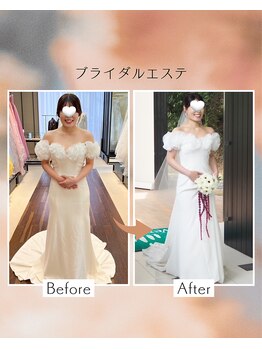 ヒーリングサロン ケリー(KELLY)/ビフォーアフターブライダル20代